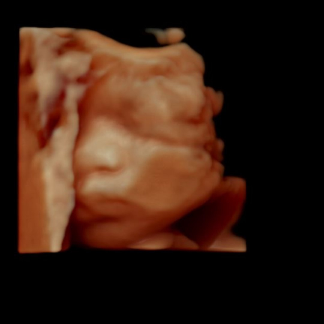 Photo shared by Leah for their Babylist baby registry.