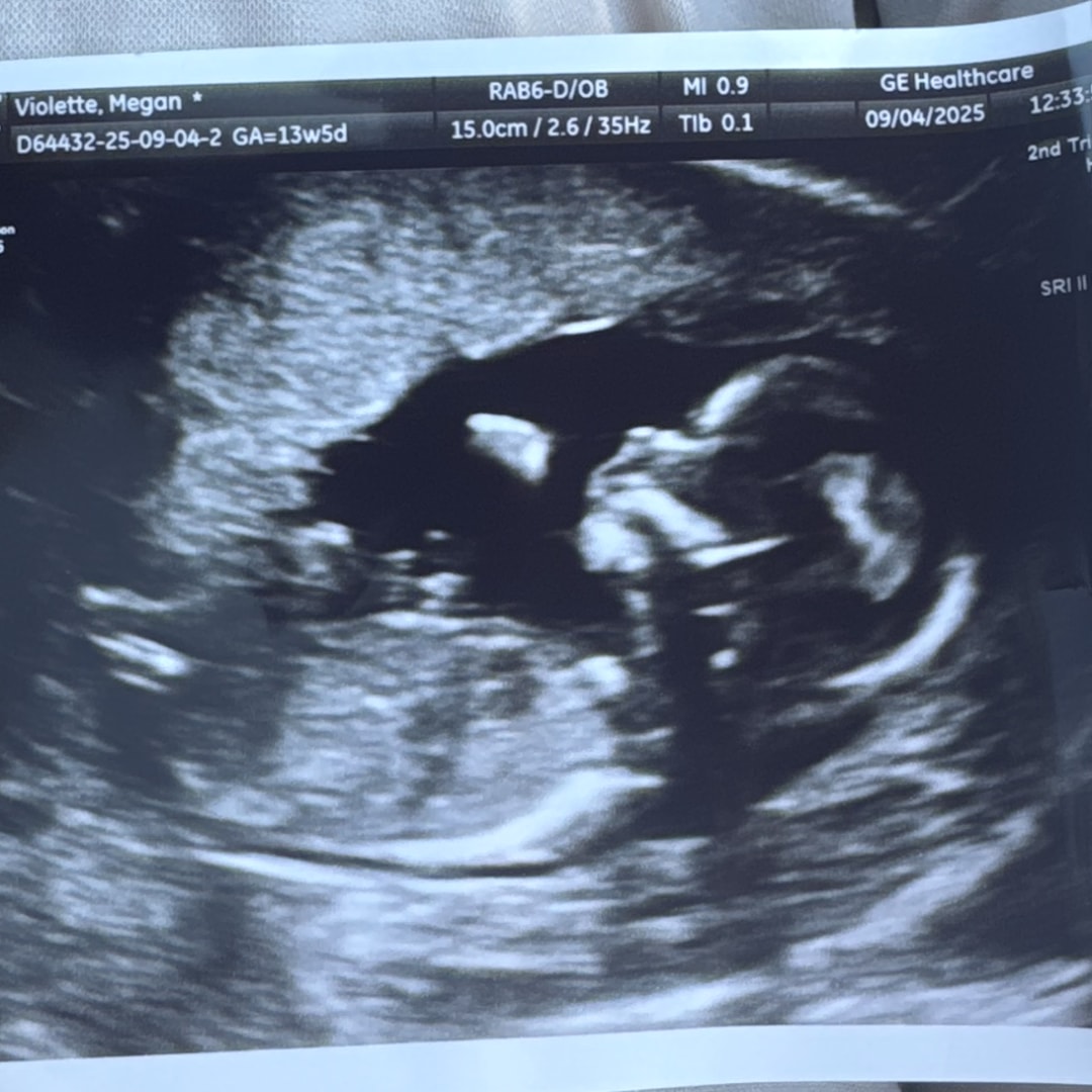 Photo shared by Megan for their Babylist baby registry.