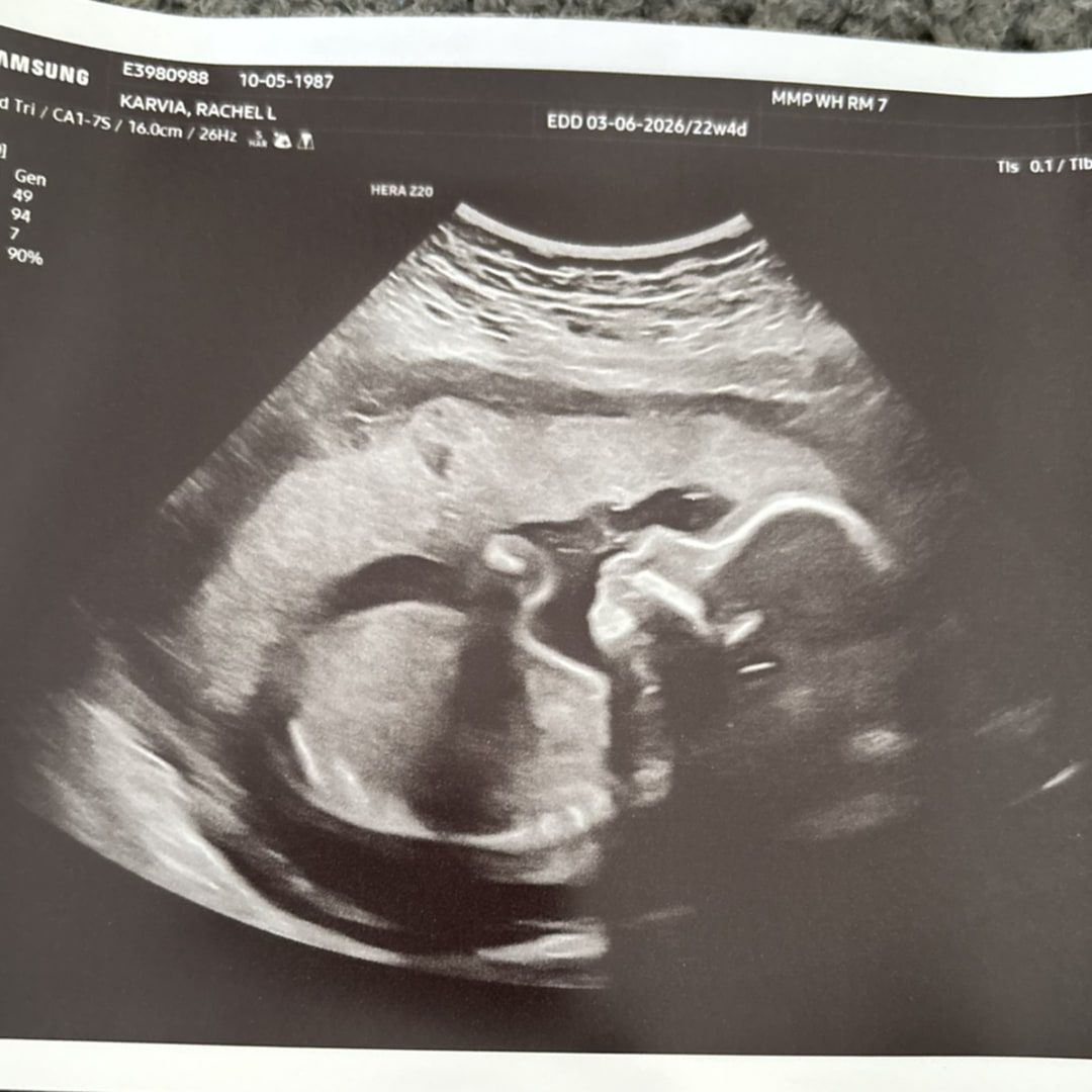 Photo shared by Rachel for their Babylist baby registry.