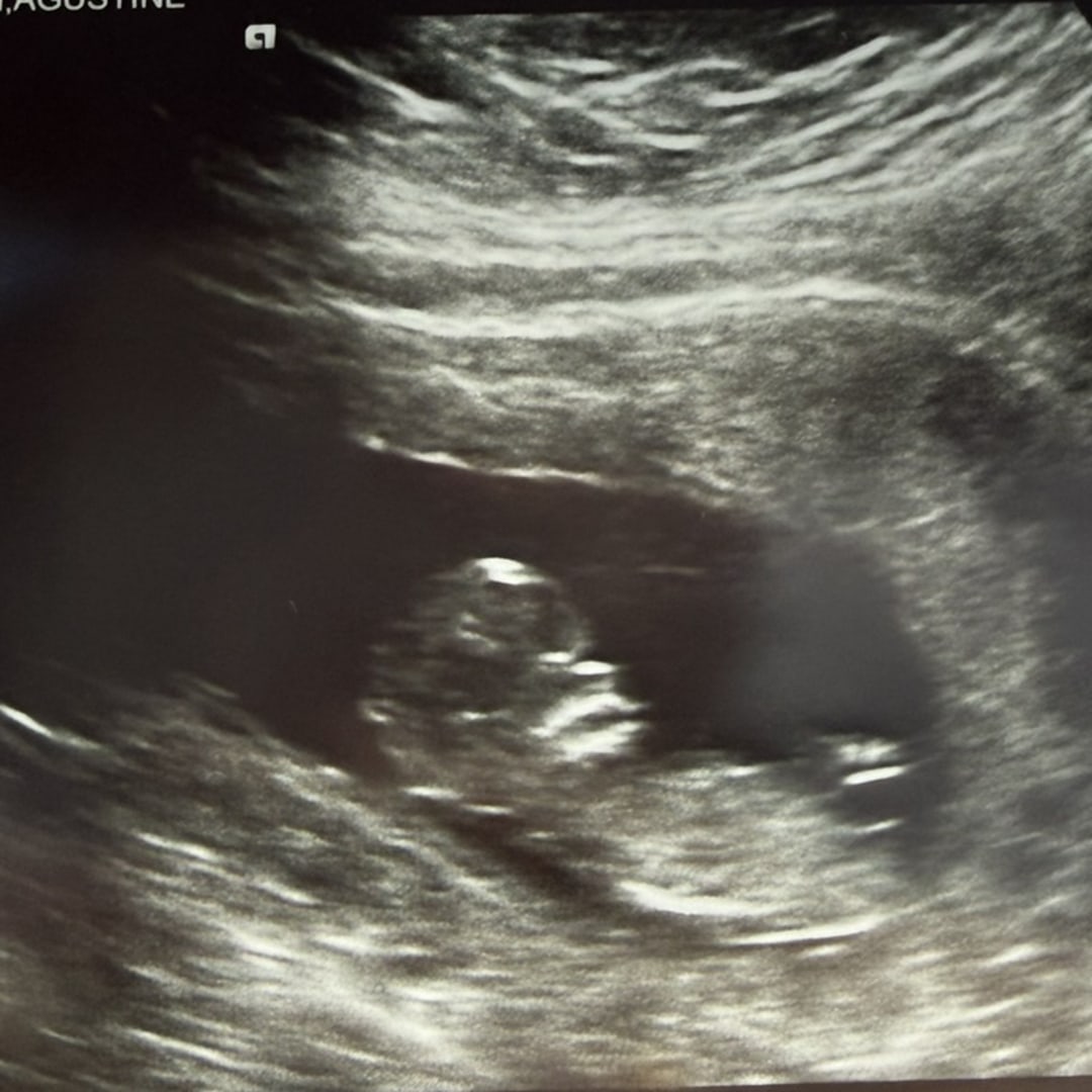 Photo shared by Agustina for their Babylist baby registry.