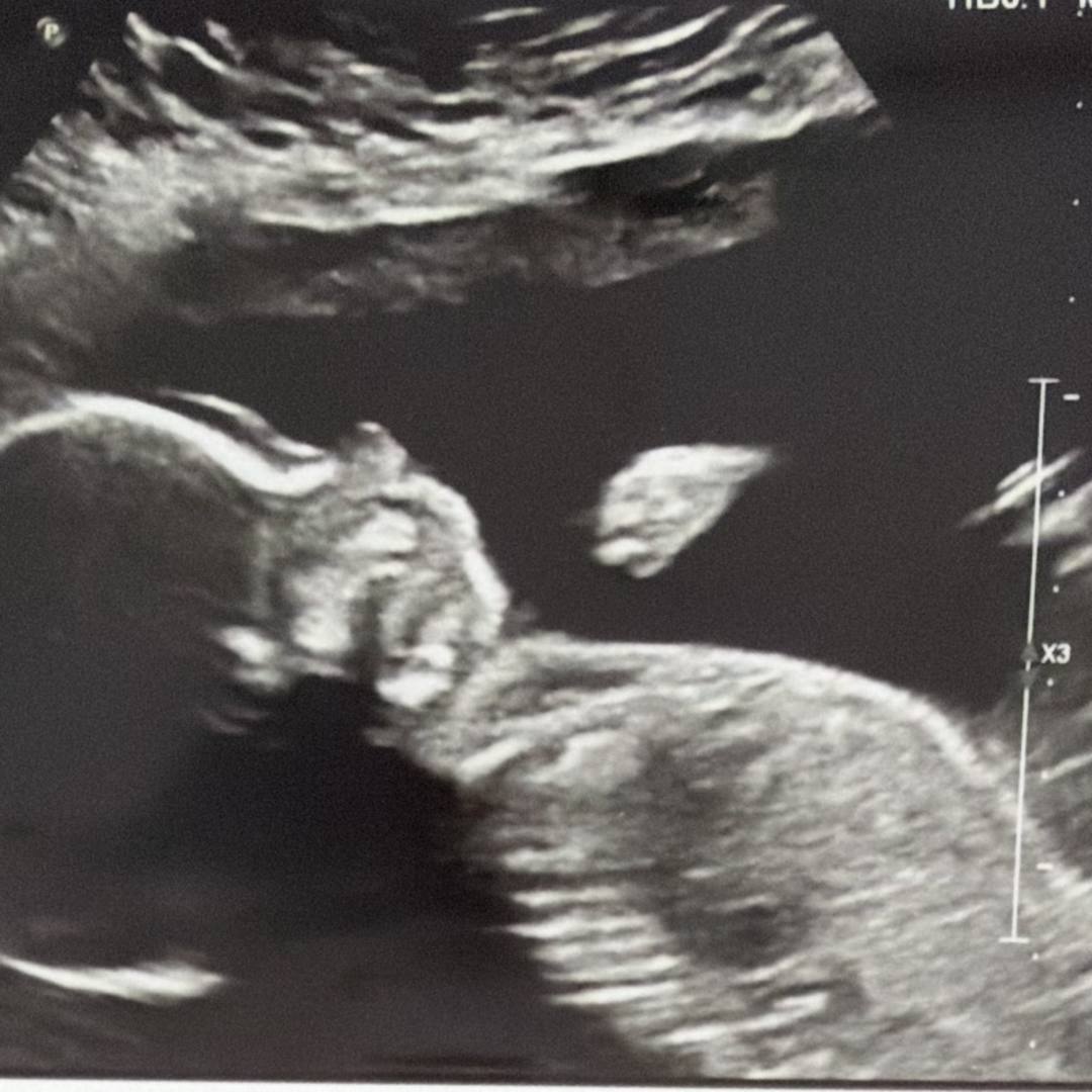 Photo shared by Meghan for their Babylist baby registry.