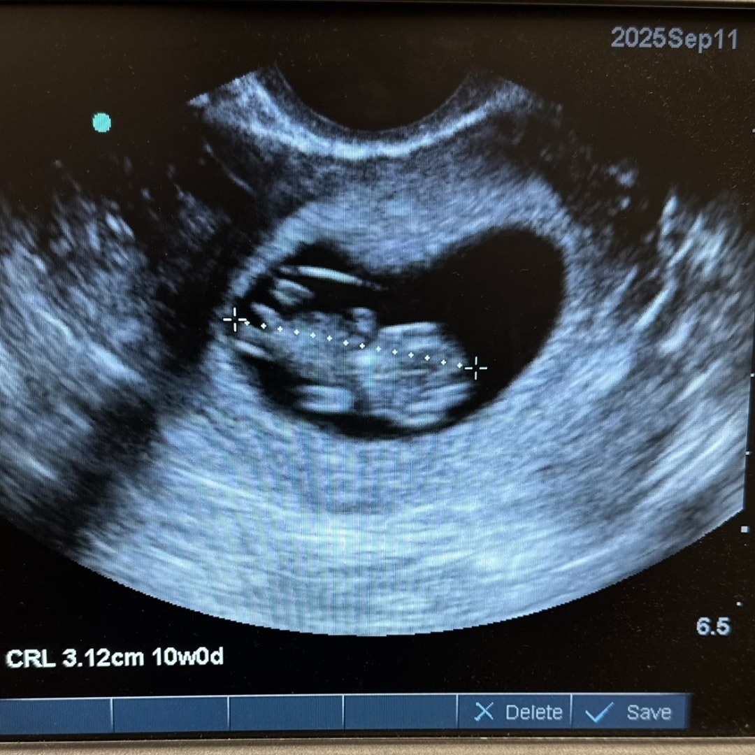 Photo shared by Amy for their Babylist baby registry.