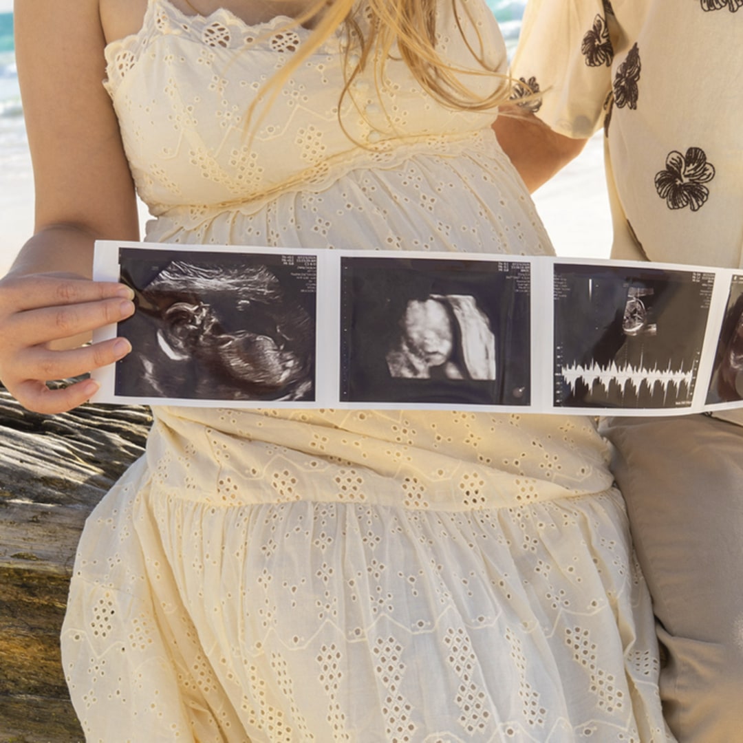 Photo shared by Brielle for their Babylist baby registry.