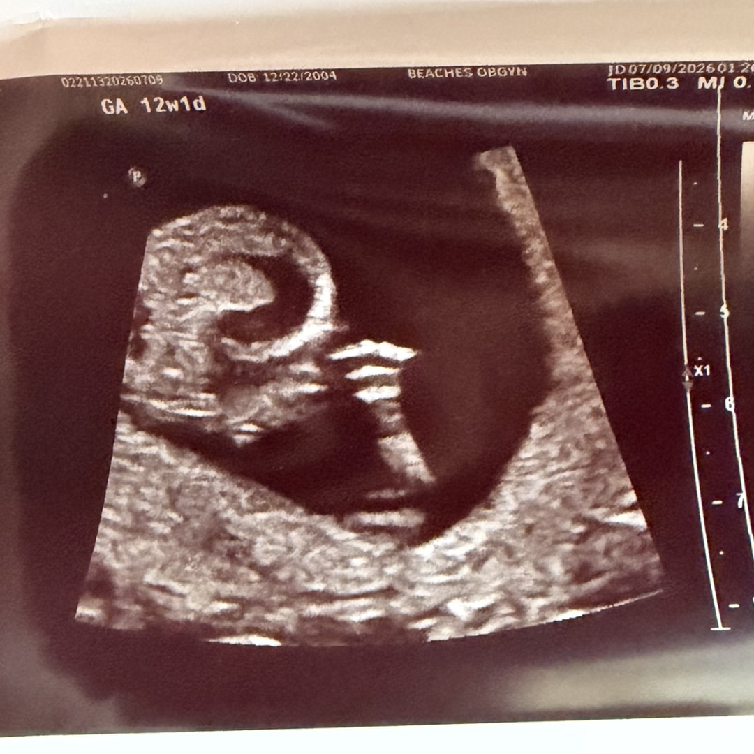 Photo shared by Isabel for their Babylist baby registry.
