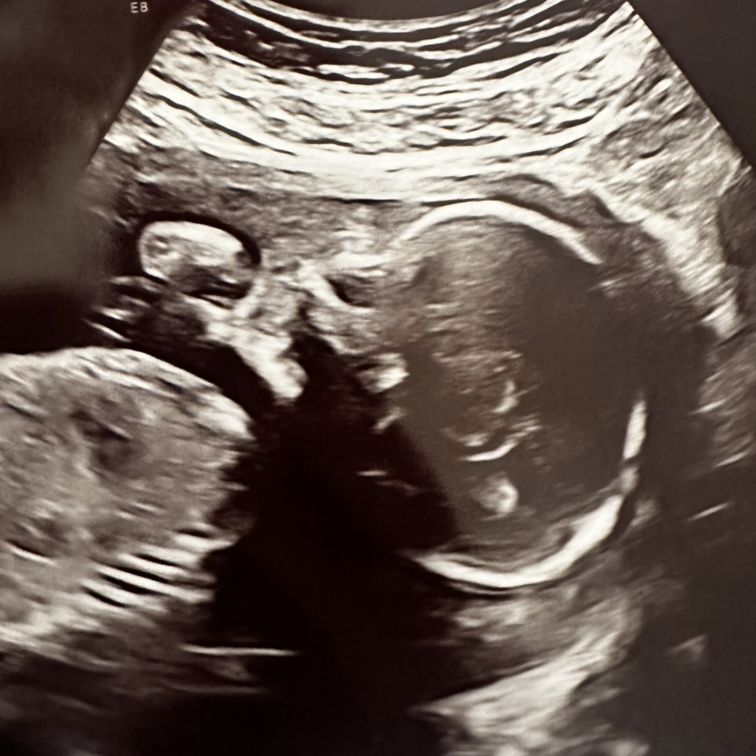 Photo shared by Viviana for their Babylist baby registry.