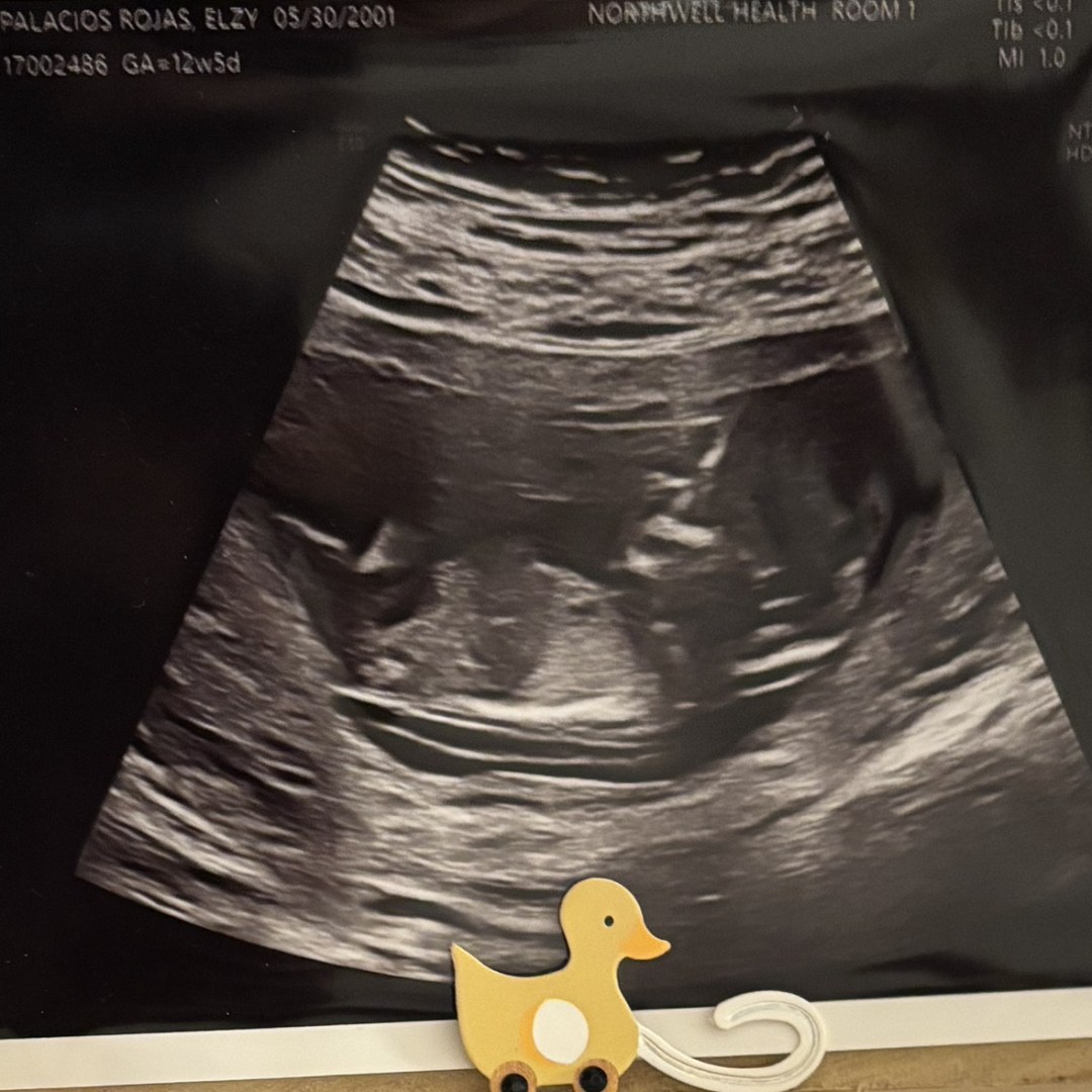 Photo shared by Elzy for their Babylist baby registry.