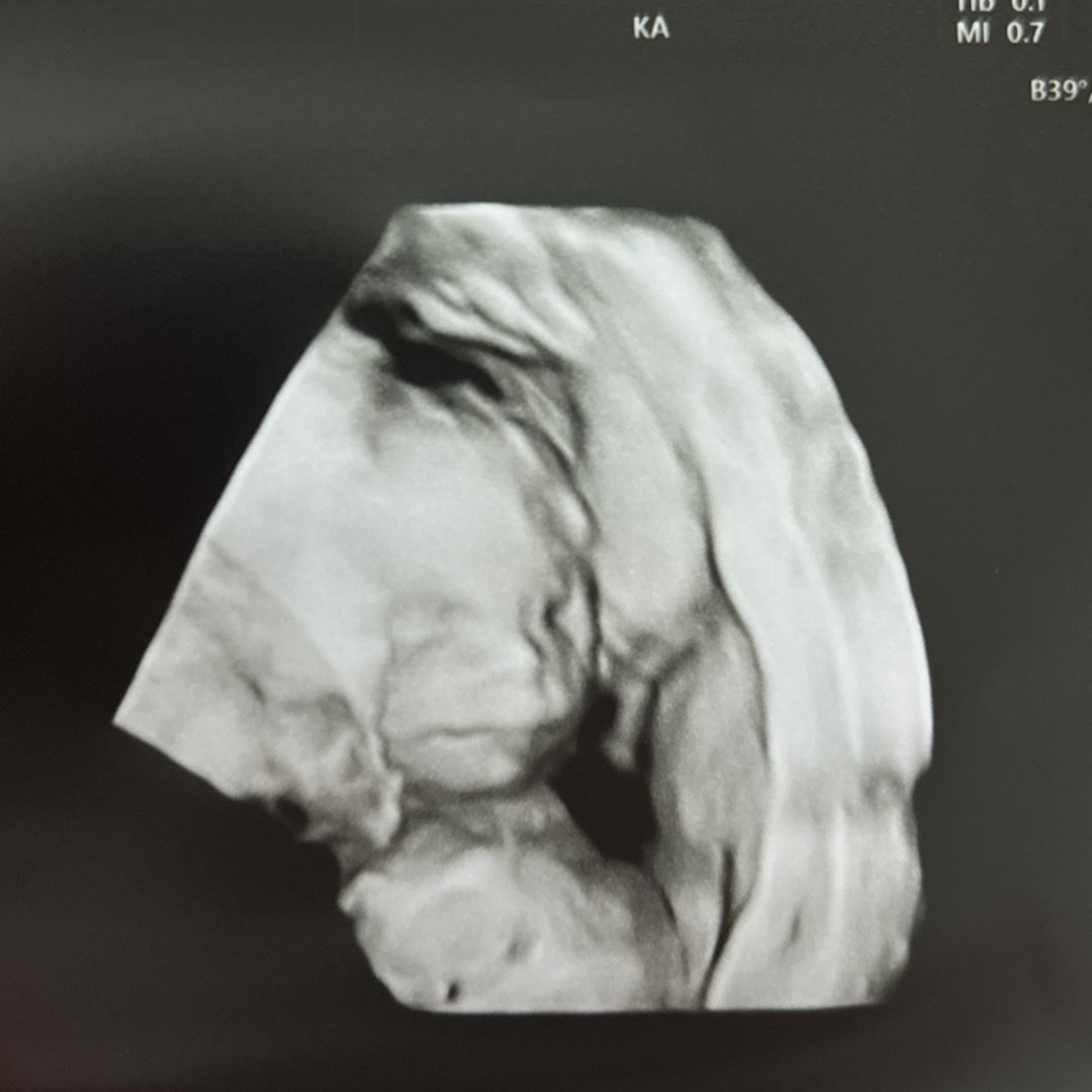 Photo shared by Andrea for their Babylist baby registry.