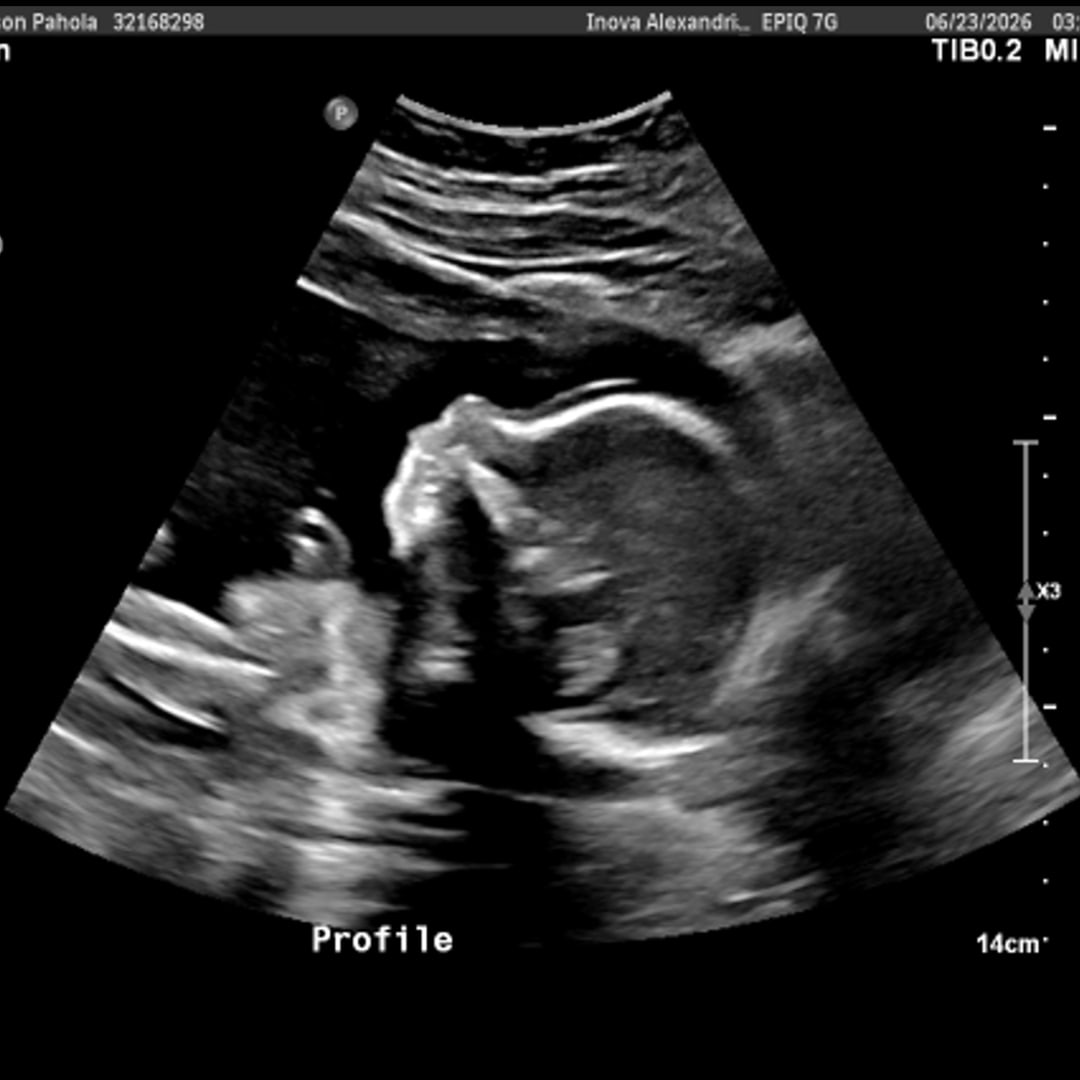 Photo shared by Allison for their Babylist baby registry.