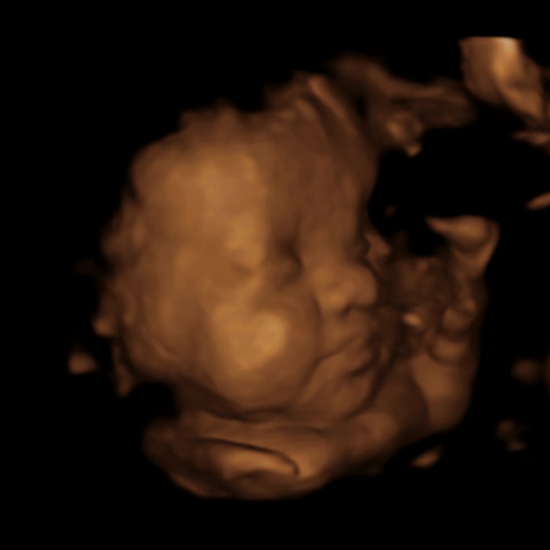 Photo shared by Katie for their Babylist baby registry.