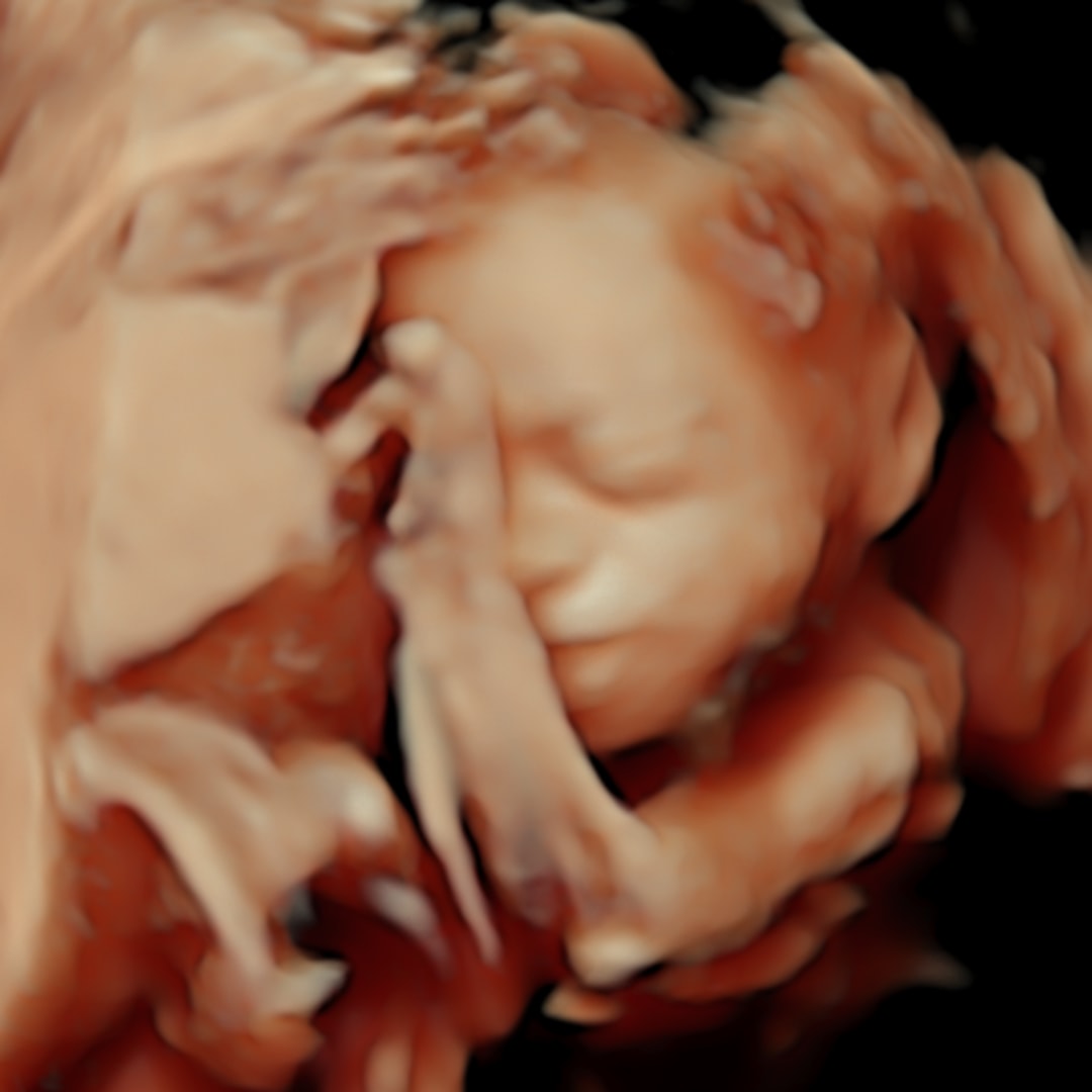 Photo shared by Lily for their Babylist baby registry.