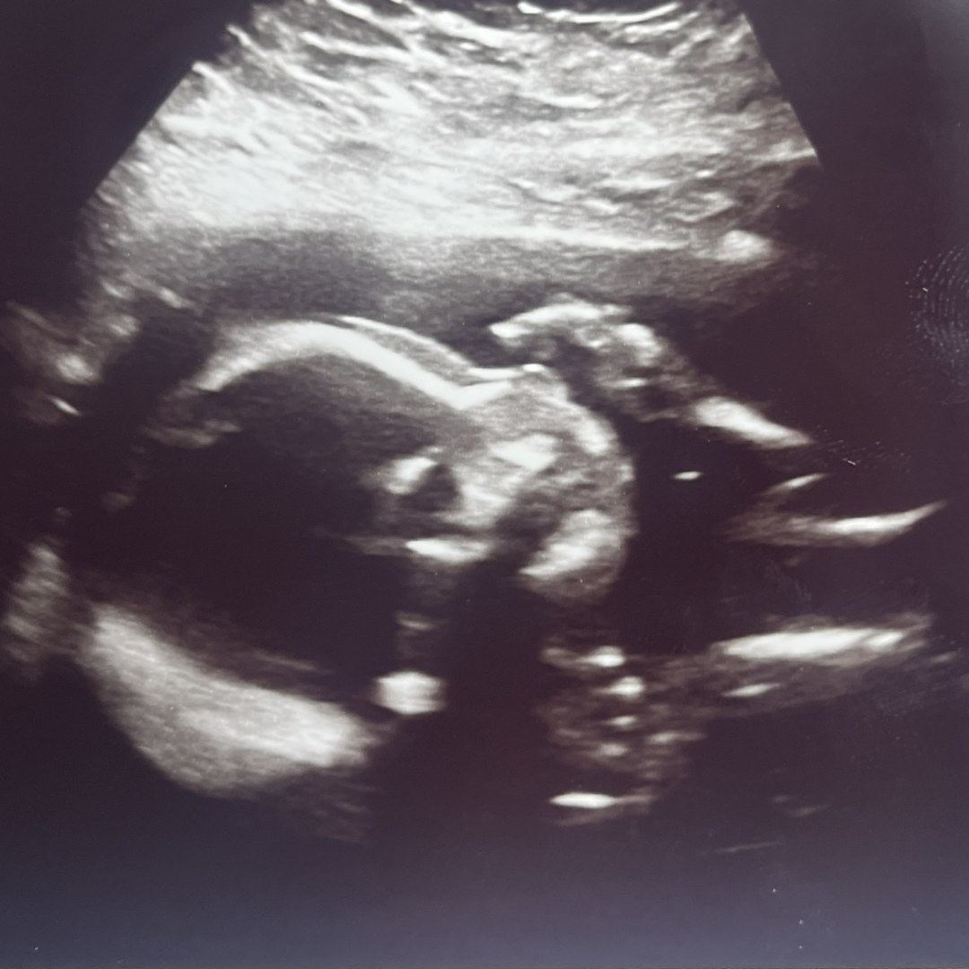 Photo shared by Xena for their Babylist baby registry.