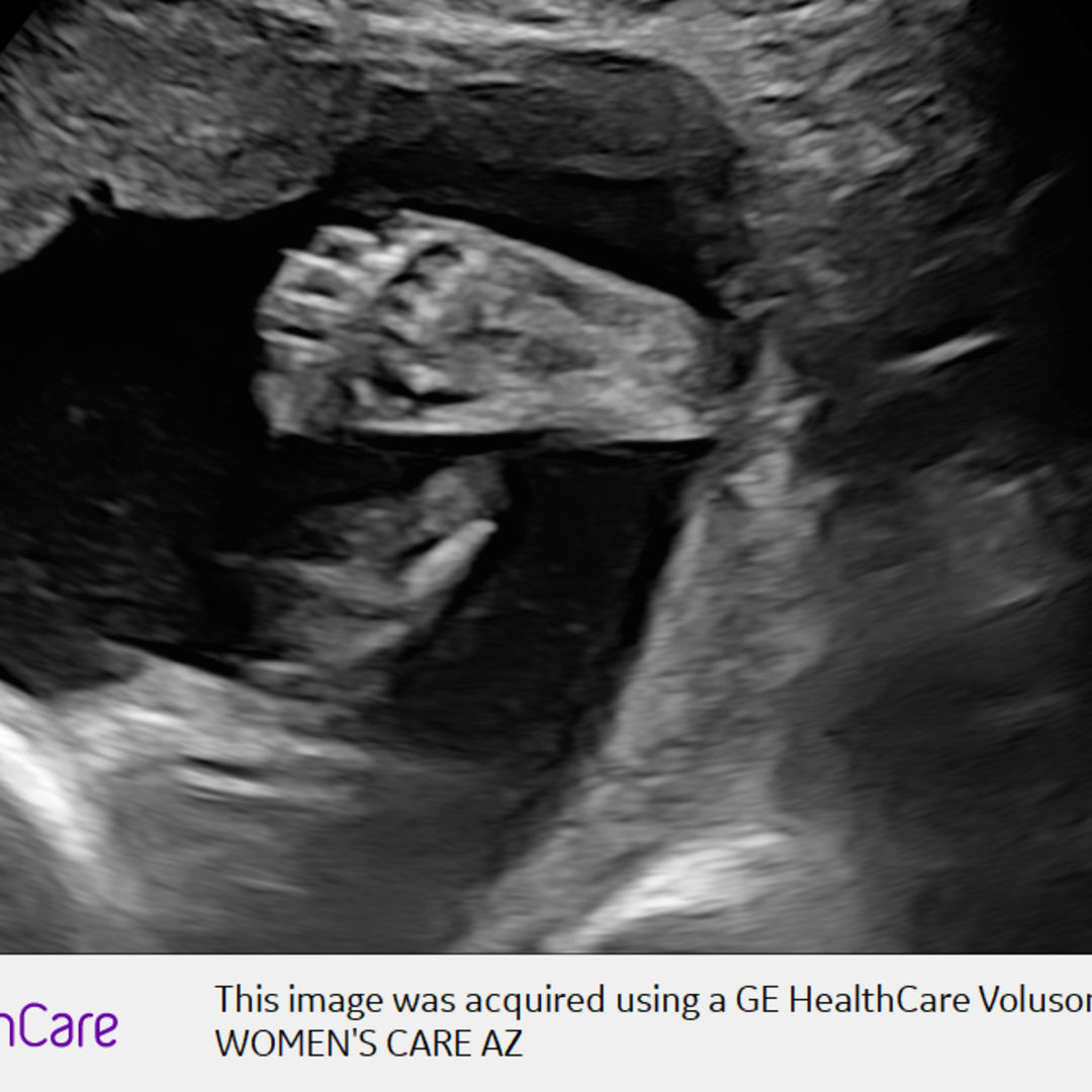 Photo shared by Kayla for their Babylist baby registry.