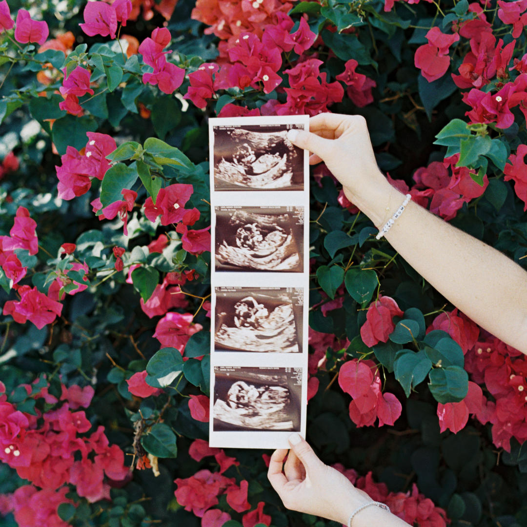 Photo shared by Hannah for their Babylist baby registry.