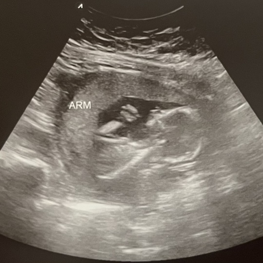 Photo shared by Angelica for their Babylist baby registry.