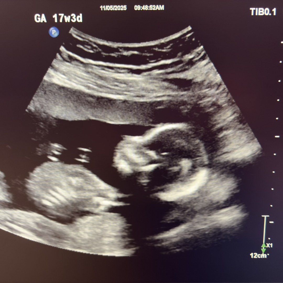 Photo shared by Samantha for their Babylist baby registry.