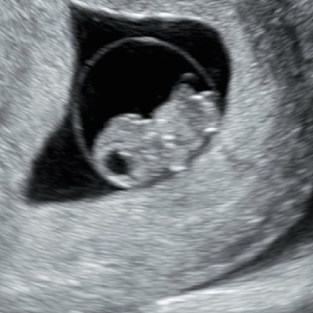 Photo shared by Breanna for their Babylist baby registry.