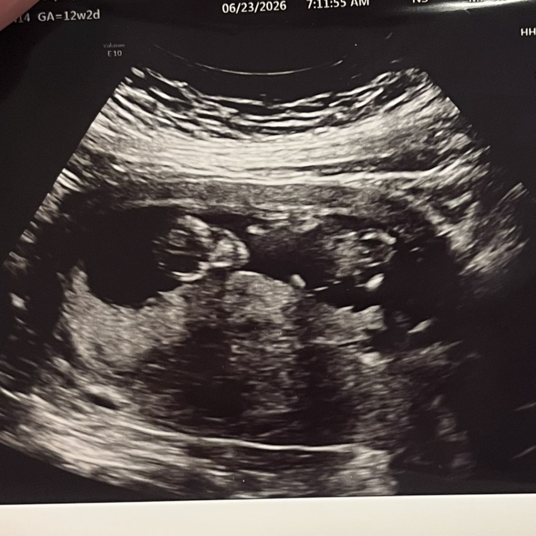 Photo shared by Valarie for their Babylist baby registry.