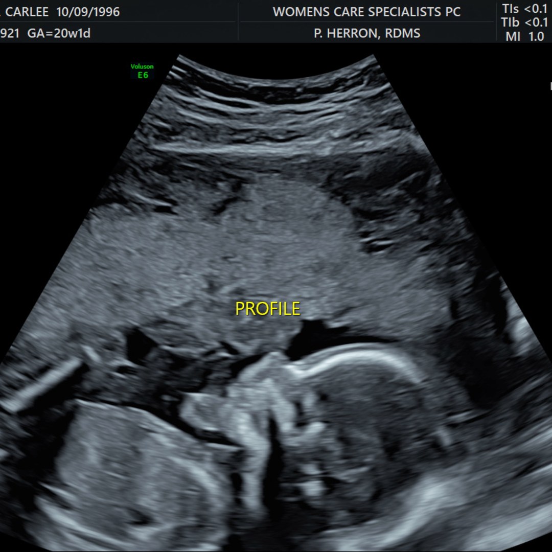 Photo shared by Carlee for their Babylist baby registry.