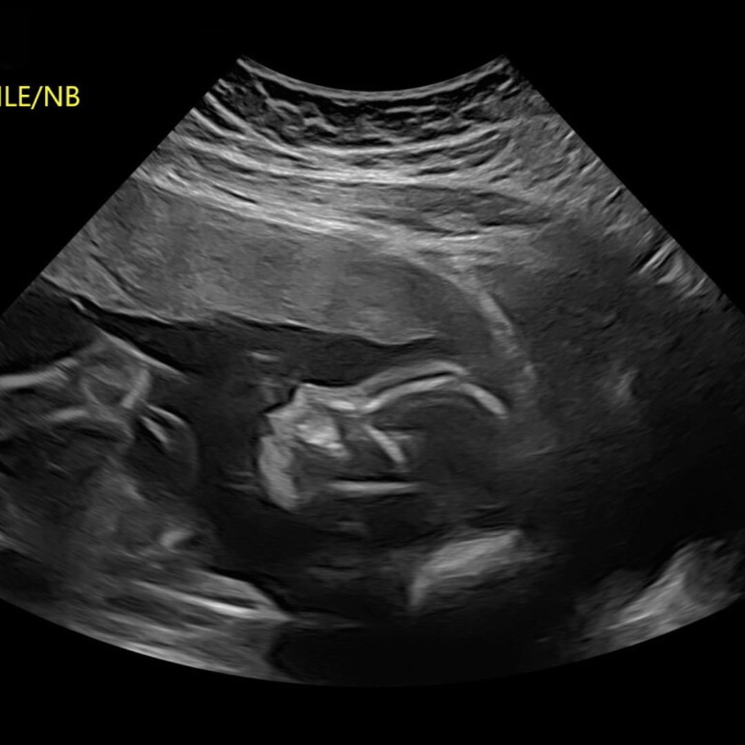 Photo shared by Olivia for their Babylist baby registry.
