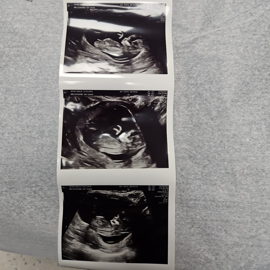 Photo shared by Naïca Weatherly for their Babylist baby registry.