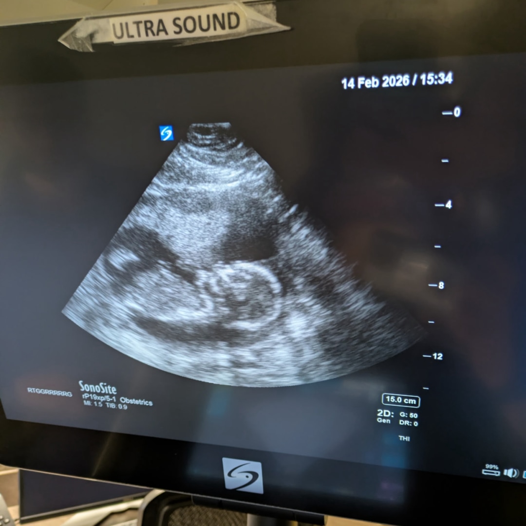 Photo shared by Kate for their Babylist baby registry.