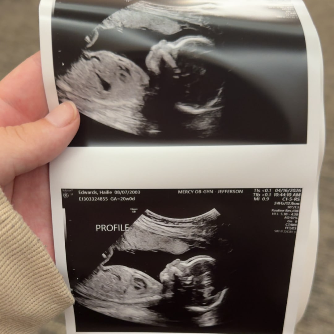 Photo shared by Hailie for their Babylist baby registry.