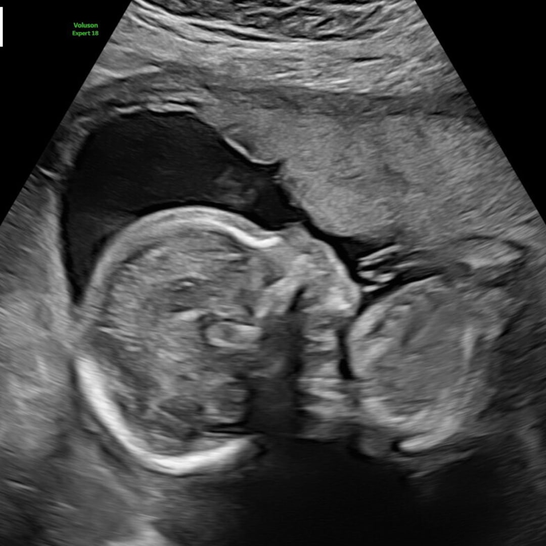 Photo shared by Alexa for their Babylist baby registry.