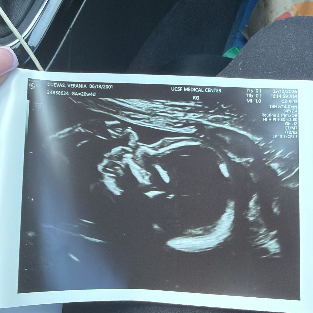 Photo shared by Verania for their Babylist baby registry.
