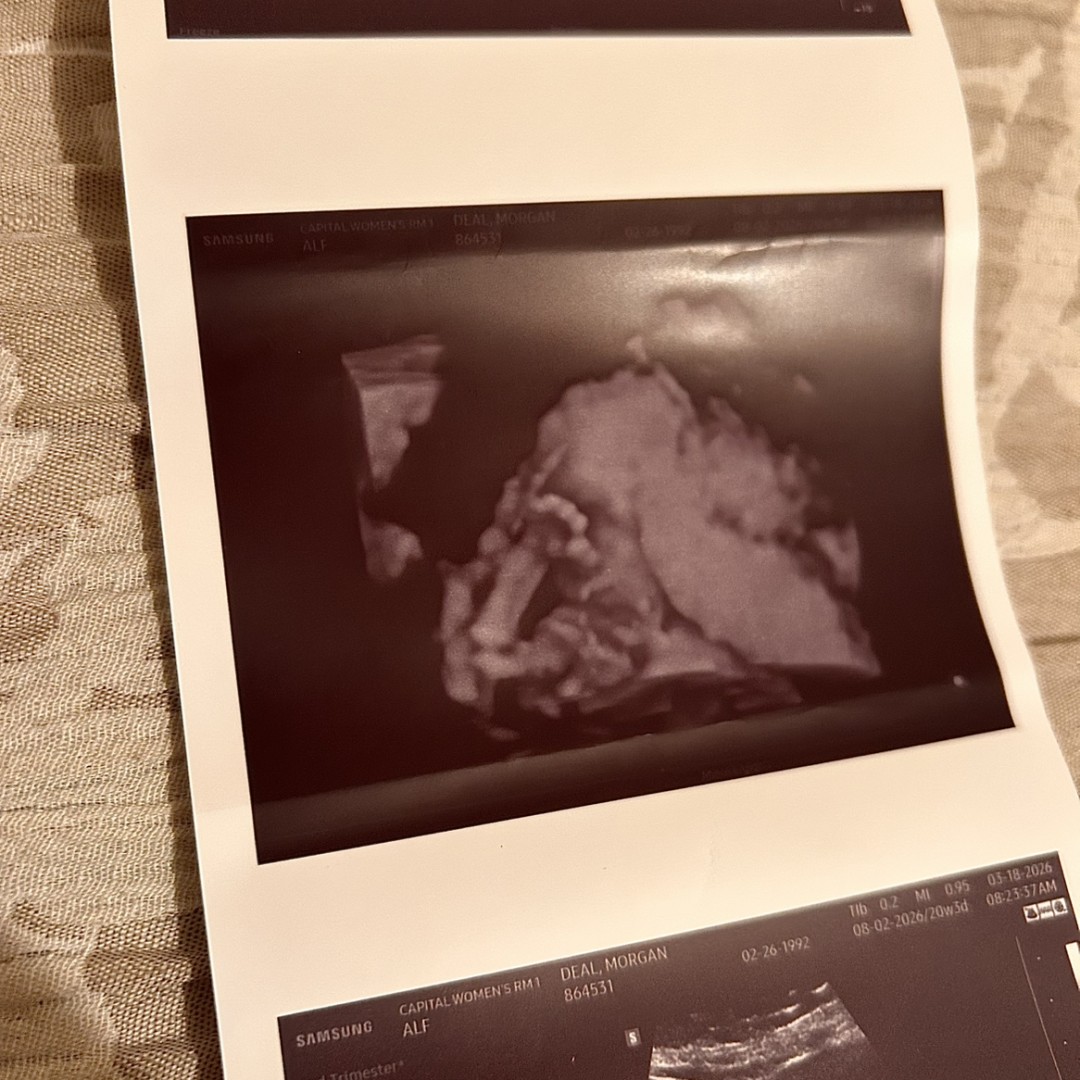 Photo shared by Morgan for their Babylist baby registry.