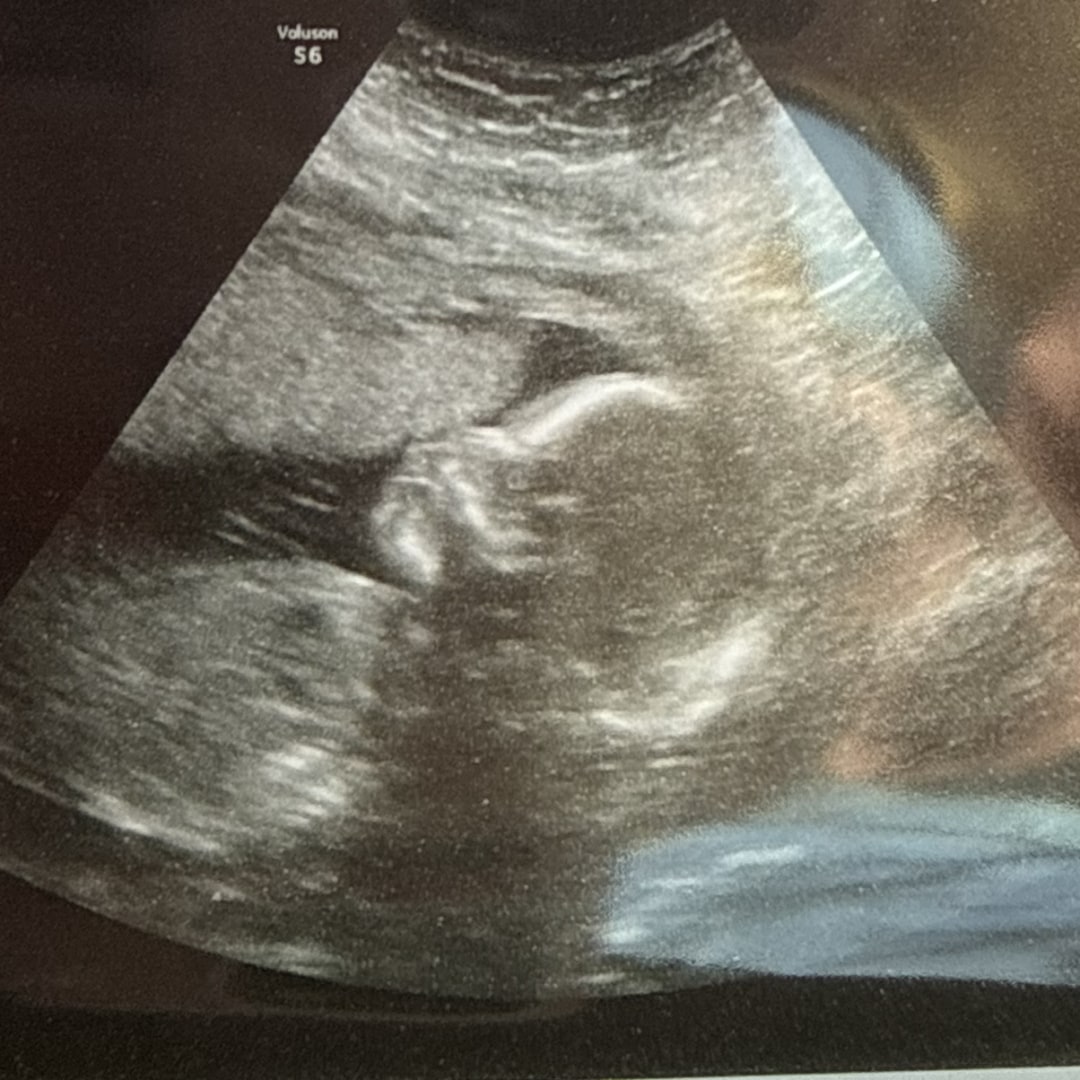 Photo shared by Sierra for their Babylist baby registry.