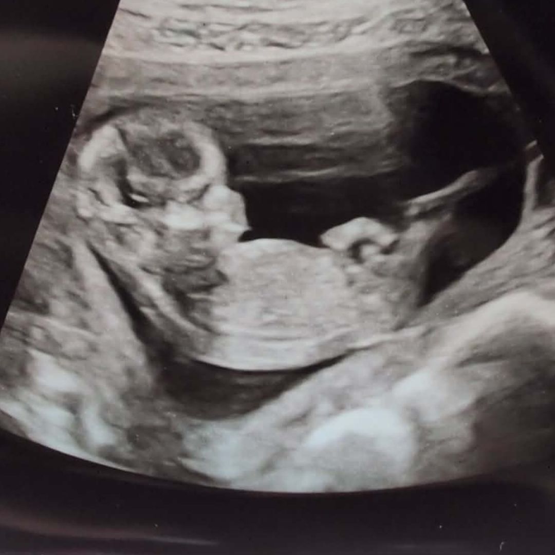 Photo shared by Sara for their Babylist baby registry.