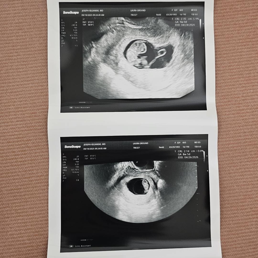 Photo shared by Laura for their Babylist baby registry.