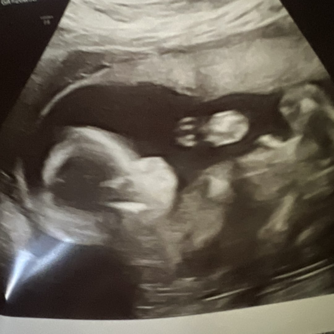 Photo shared by Lara for their Babylist baby registry.