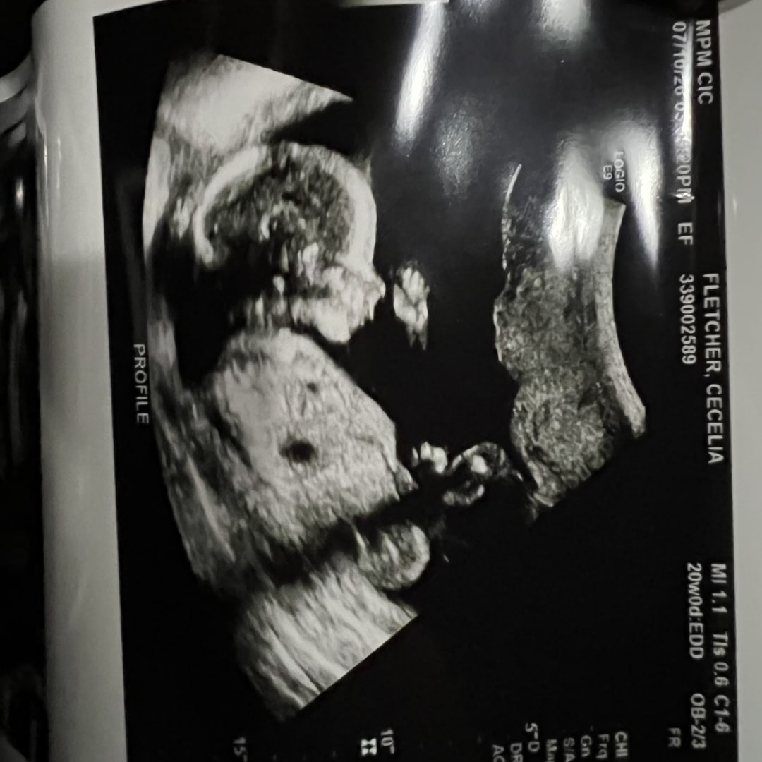 Photo shared by Cece for their Babylist baby registry.
