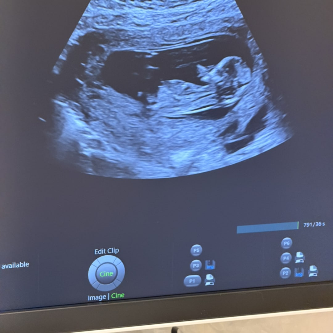 Photo shared by Lesly for their Babylist baby registry.
