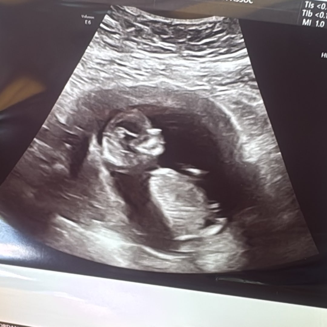 Photo shared by Jordan for their Babylist baby registry.