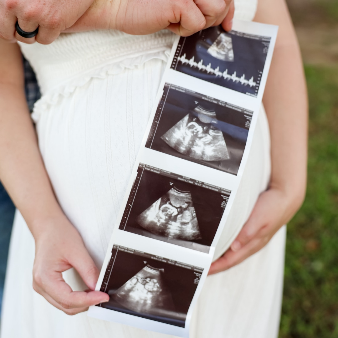Photo shared by Cesilee for their Babylist baby registry.