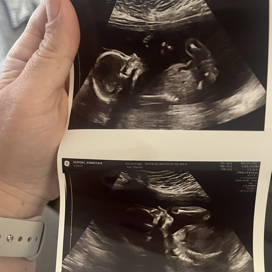 Photo shared by Jenny for their Babylist baby registry.