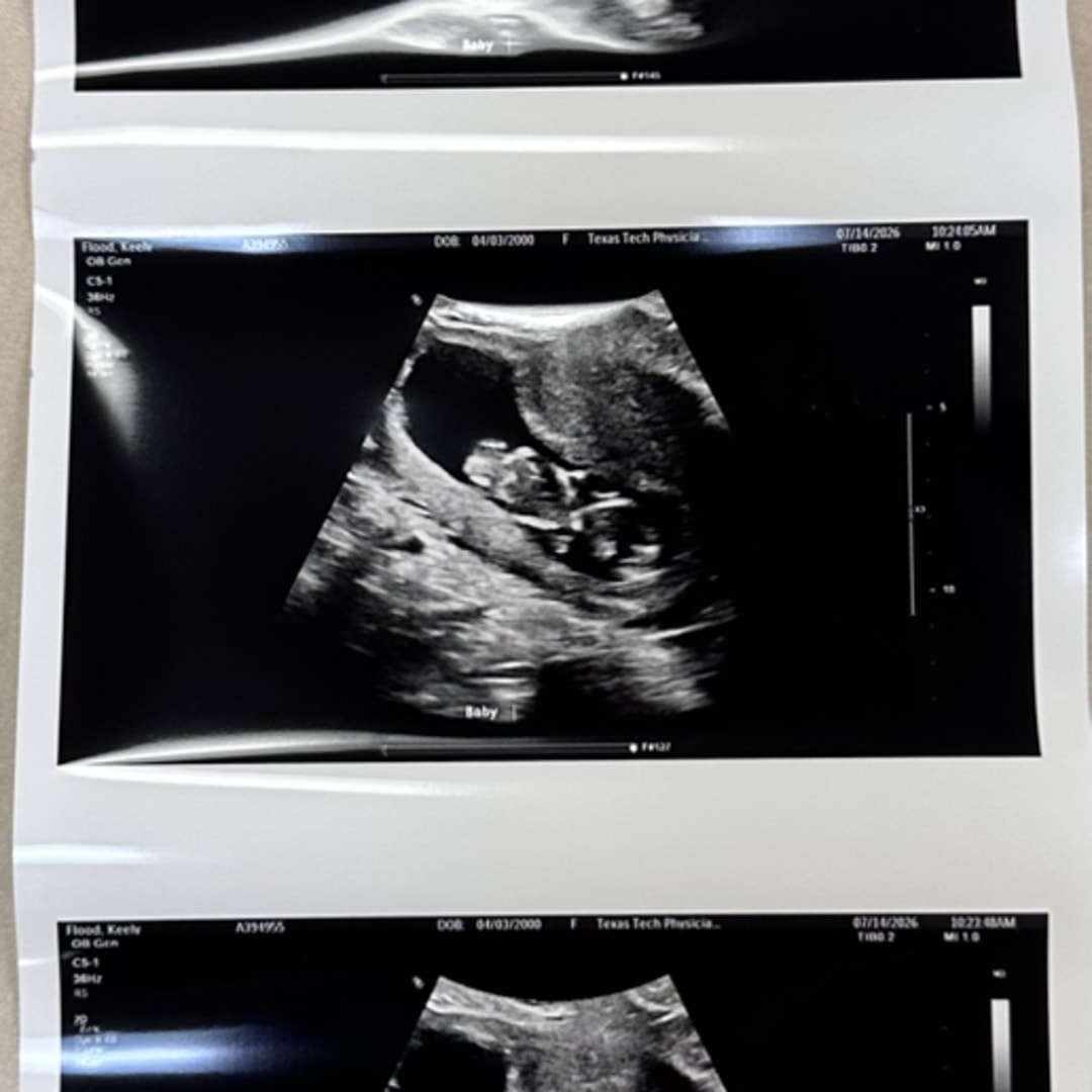 Photo shared by Keely for their Babylist baby registry.