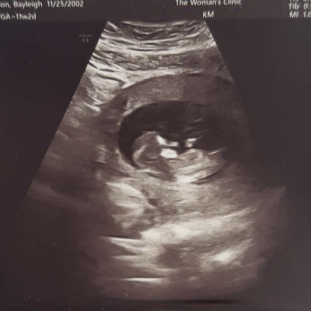 Photo shared by Bayleigh for their Babylist baby registry.