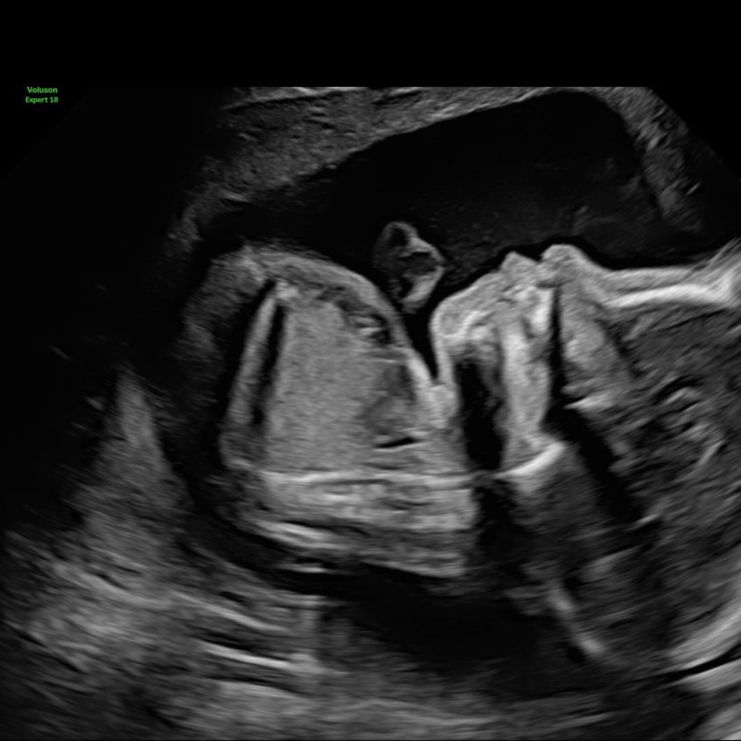 Photo shared by Taylor for their Babylist baby registry.