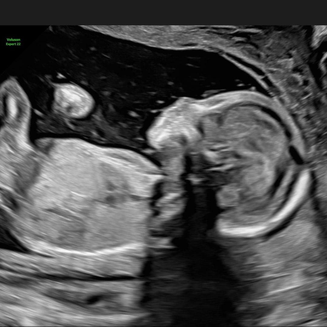 Photo shared by Skyler for their Babylist baby registry.