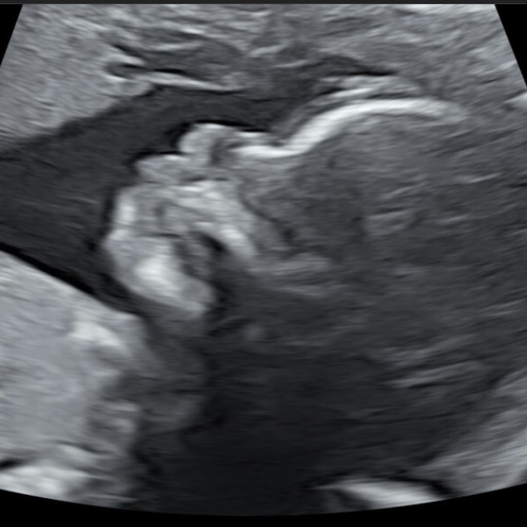 Photo shared by Alexandria for their Babylist baby registry.