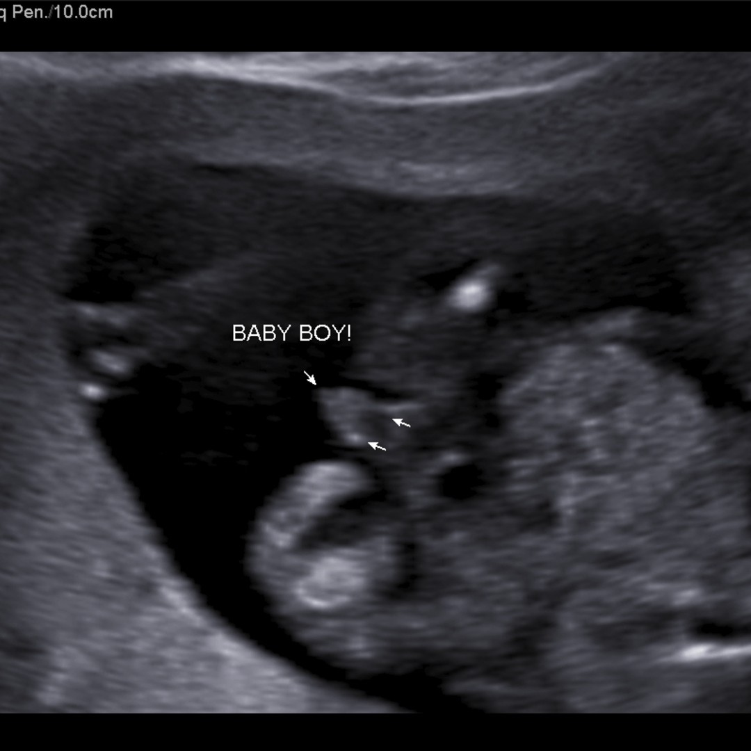 Photo shared by Ricca for their Babylist baby registry.