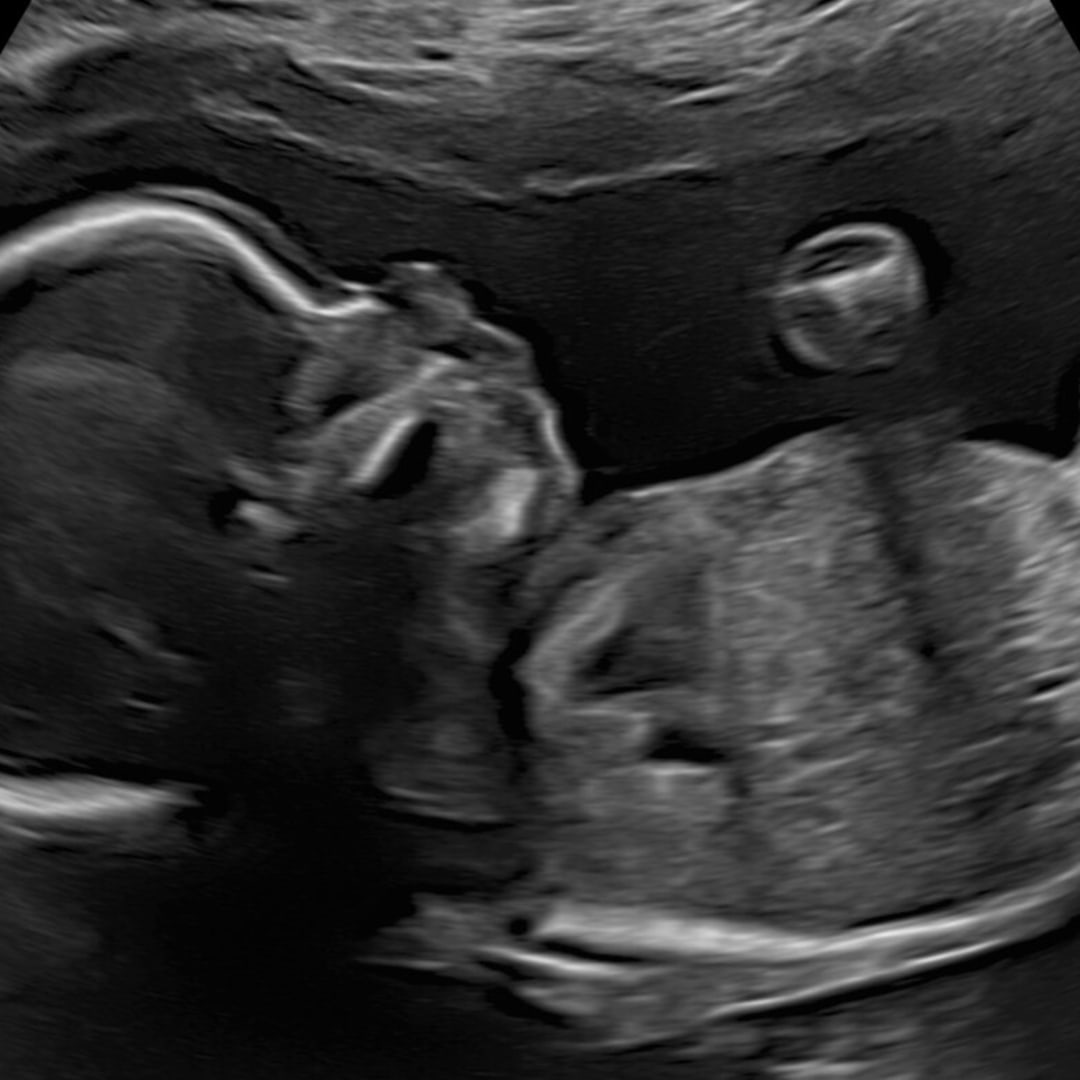 Photo shared by Rico for their Babylist baby registry.