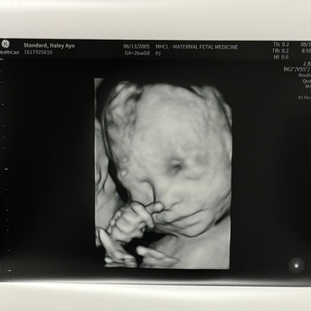 Photo shared by Haley for their Babylist baby registry.