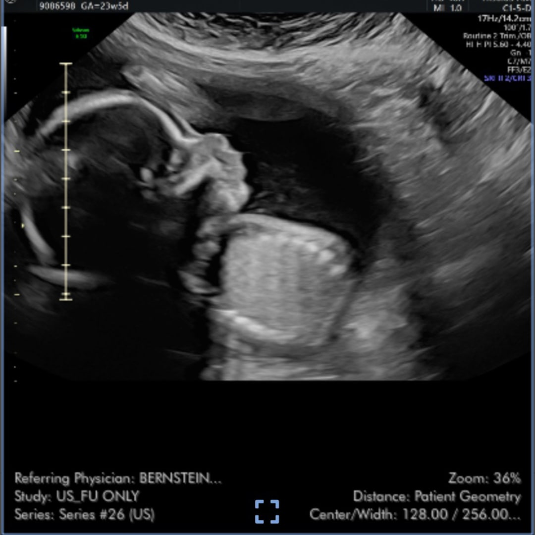 Photo shared by Megan for their Babylist baby registry.