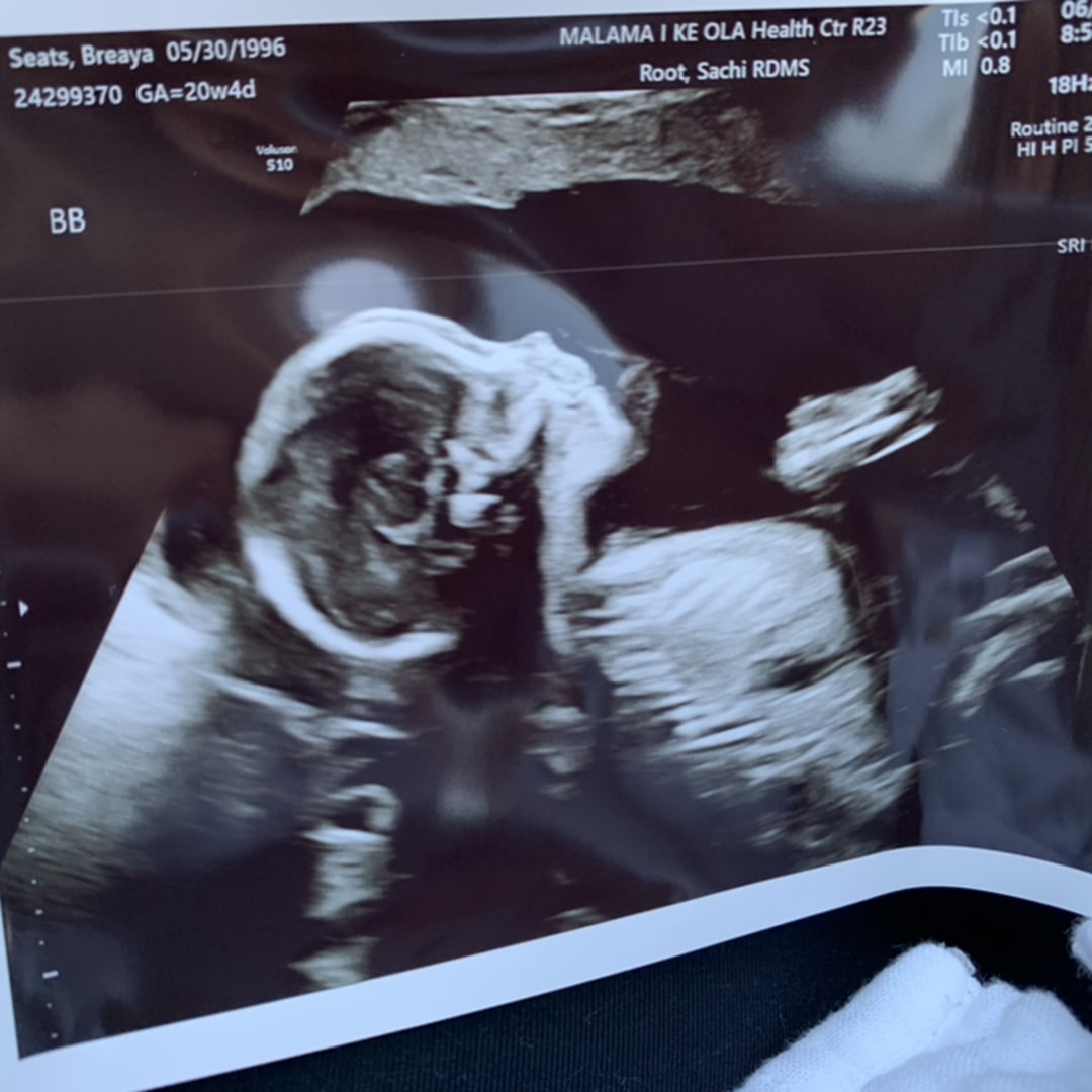 Photo shared by Breáya for their Babylist baby registry.