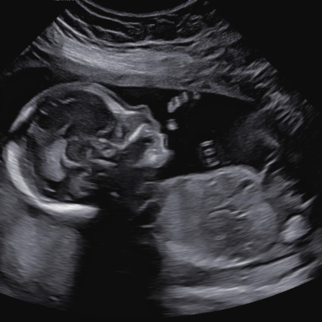 Photo shared by Jenna for their Babylist baby registry.