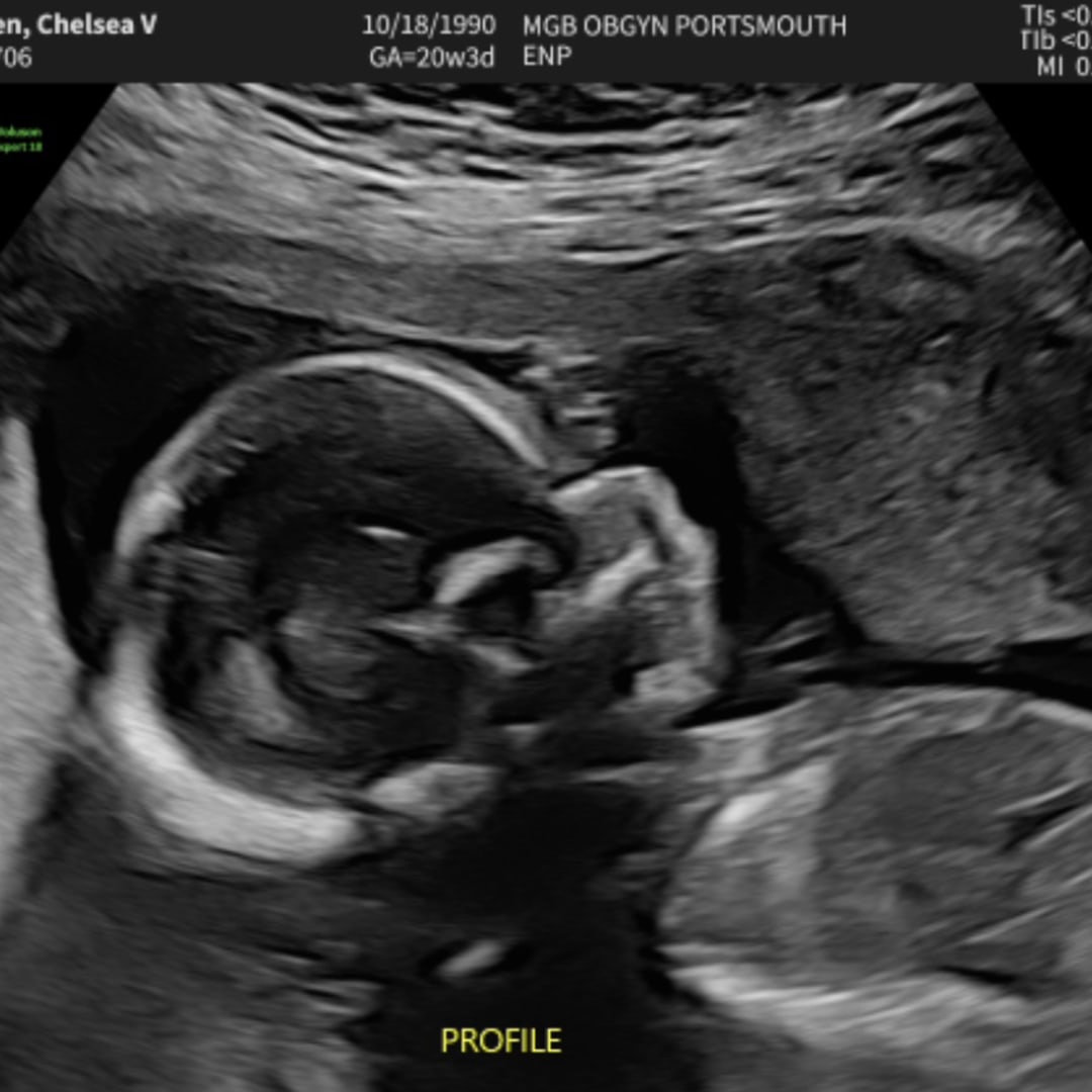 Photo shared by Chelsea for their Babylist baby registry.